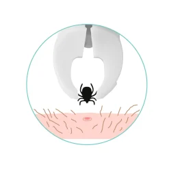 Zeckengreifer tickSAFE, Tier, mit rotierendem Greiferkopf
